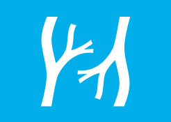 Trombosi dell’arteria e vena centrale della retina