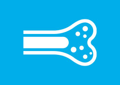 Osteomielite acuta e refrattaria cronica